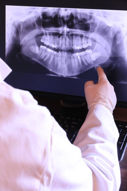 Best Emergency Wisdom Tooth Extraction in Jonesboro, IN